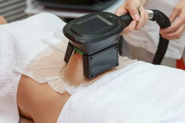 Image of person having fat freezing treatment to help weight gain Leominster
