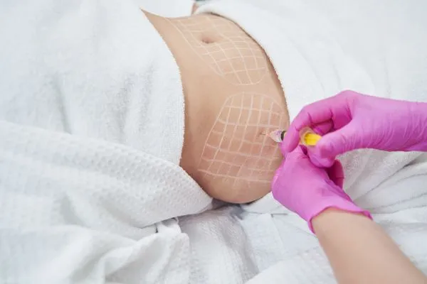 image of fat dissolving injections on love handles to help combat weight gain Leominster