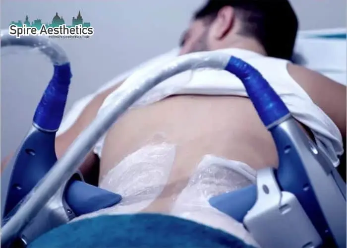 Man having fat freezing treatment done on love handles before a competitions Leominster to create a sculpted look.