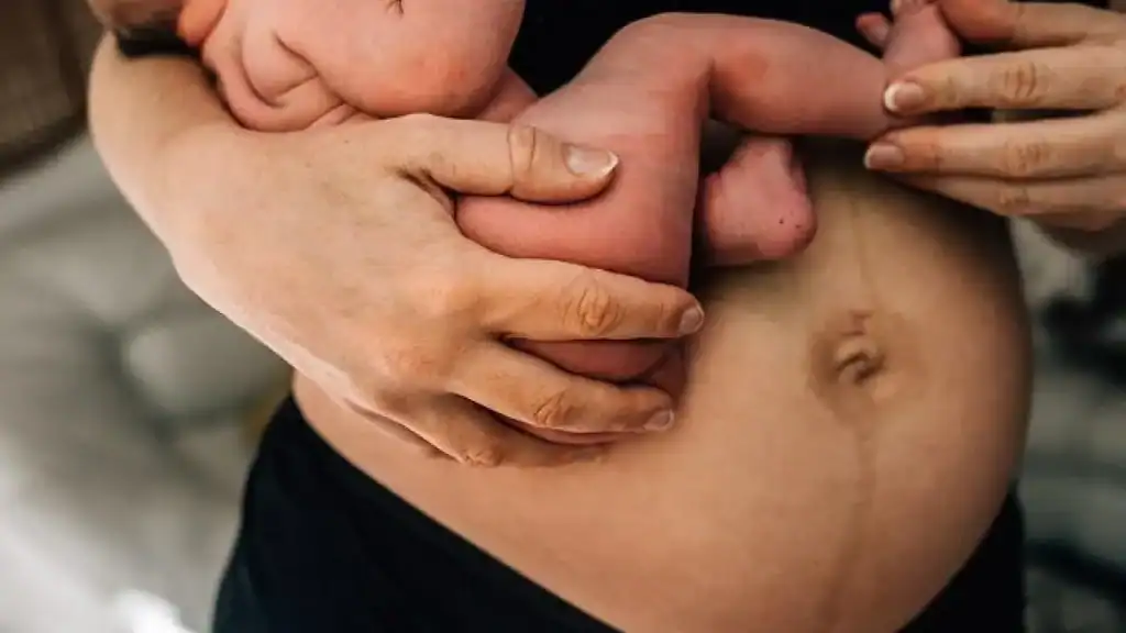 Why Is My Stomach Still Big After Pregnancy Leominster?