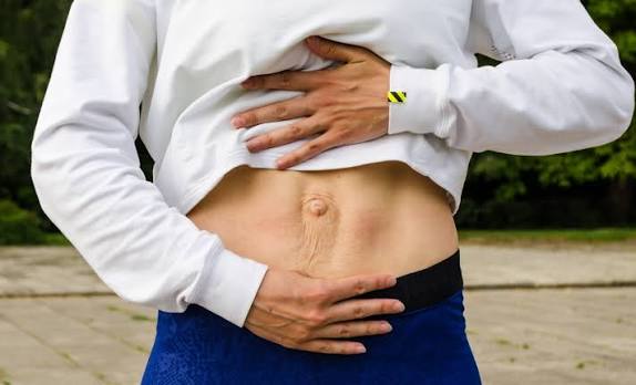 When Could Diastasis Recti Be the Missing Piece of the Puzzle Leominster?